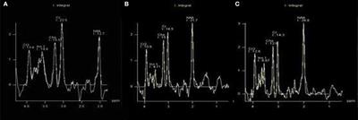 Correlation Between Diabetic Cognitive Impairment and Diabetic Retinopathy in Patients With T2DM by 1H-MRS